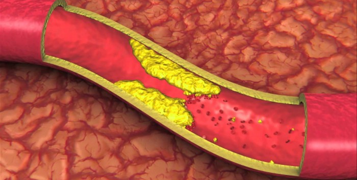 Pastroni arteriet koronare me këtë recetë të lehtë