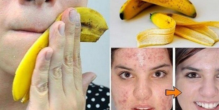 Mos i hidhni më LIVORET E BANANEVE! Ja si mund t’i përdorni ato